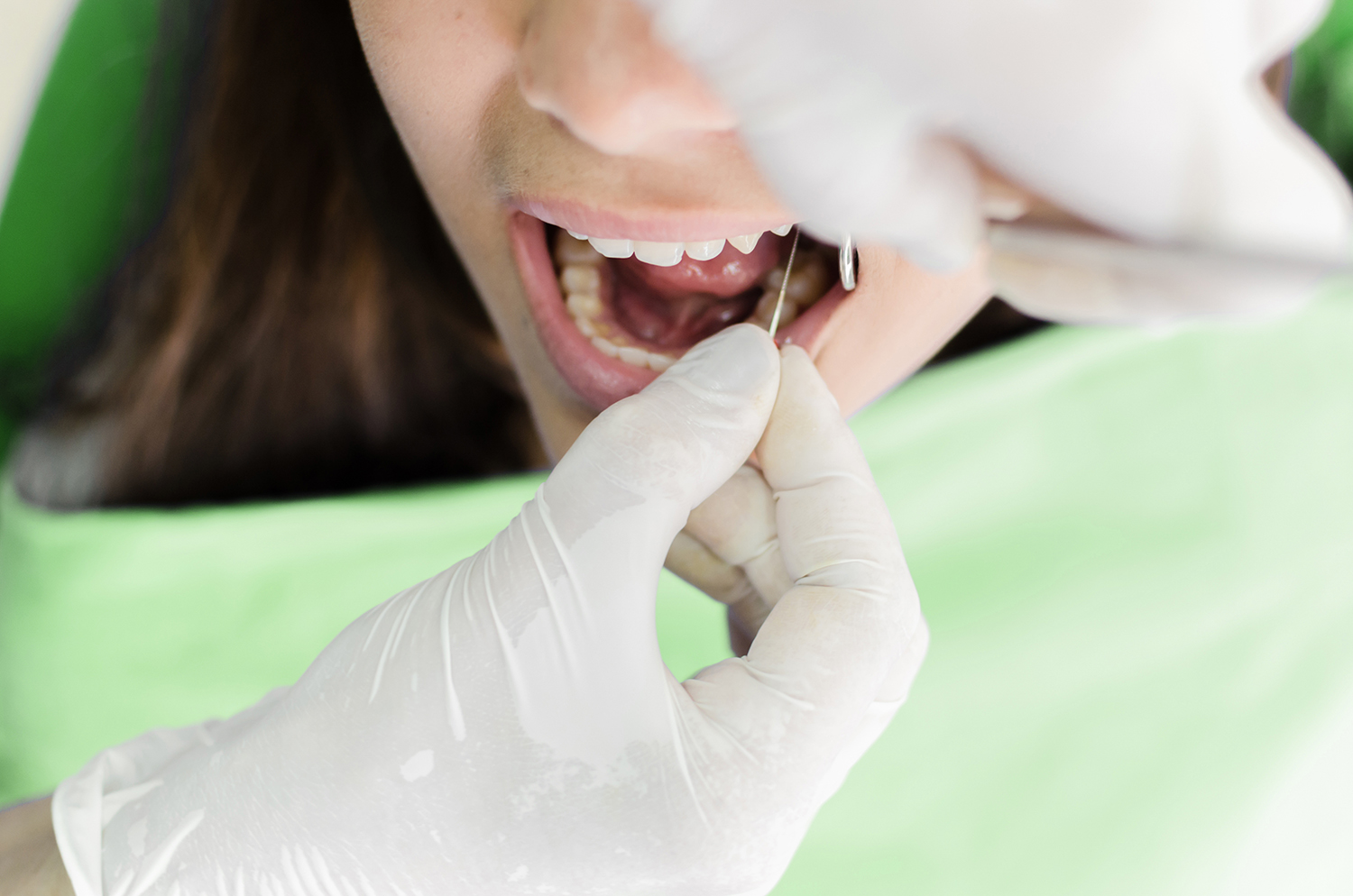 Nytt tannhelsetilbud til 21-og 22-åringer